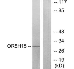 Western Blot - Anti-OR5H15 Antibody (G479) - Antibodies.com