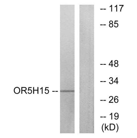 Western Blot - Anti-OR5H15 Antibody (G479) - Antibodies.com