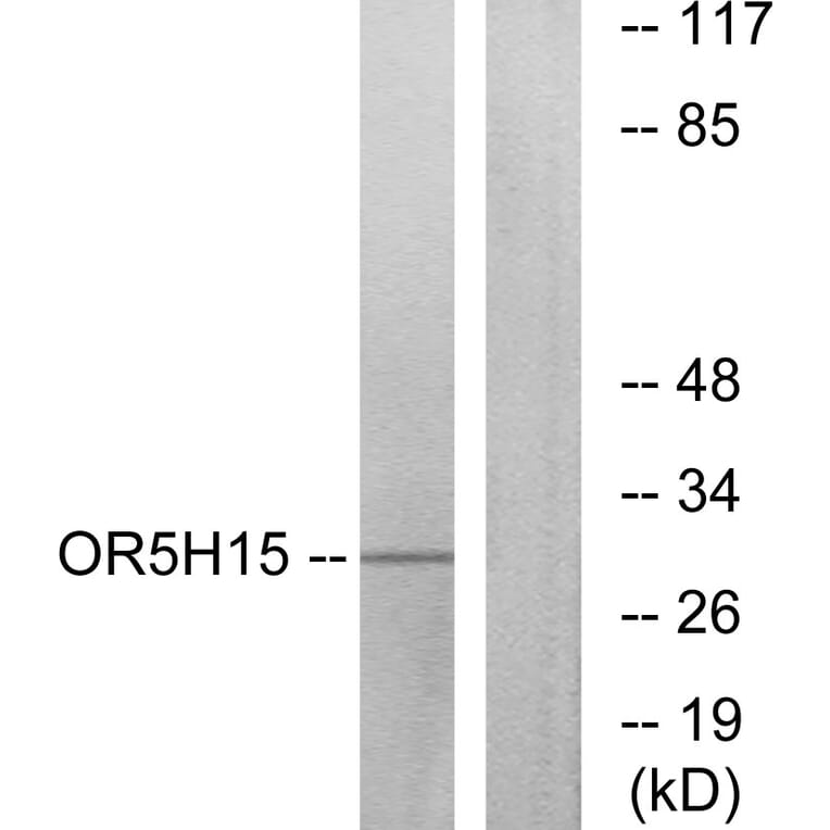 Western Blot - Anti-OR5H15 Antibody (G479) - Antibodies.com