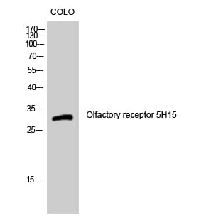 Anti-OR5H15 Antibody (A99510) | Antibodies.com