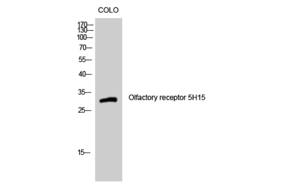 Western Blot - Anti-OR5H15 Antibody (G479) - Antibodies.com