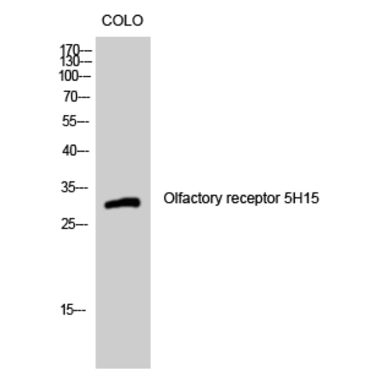 Western Blot - Anti-OR5H15 Antibody (G479) - Antibodies.com