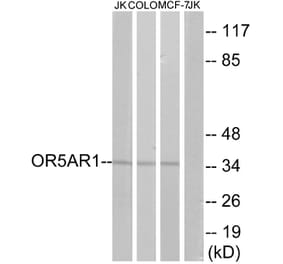 Western Blot - Anti-OR5AR1 Antibody (G625) - Antibodies.com