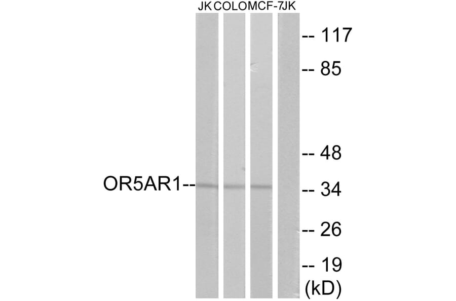 Western Blot - Anti-OR5AR1 Antibody (G625) - Antibodies.com