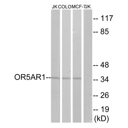 Western Blot - Anti-OR5AR1 Antibody (G625) - Antibodies.com