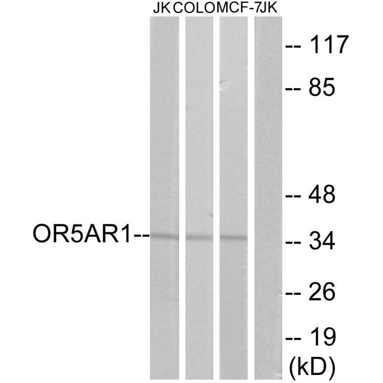 Western Blot - Anti-OR5AR1 Antibody (G625) - Antibodies.com