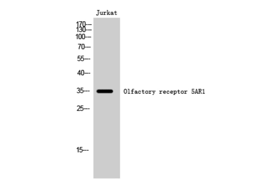 Western Blot - Anti-OR5AR1 Antibody (G625) - Antibodies.com