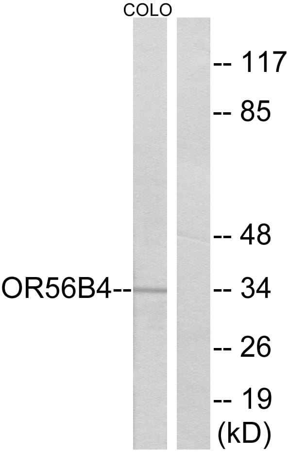 Western blot analysis of lysates from COLO cells using Anti-OR56B4 Antibody. The right hand lane represents a negative control, where the antibody is blocked by the immunising peptide.