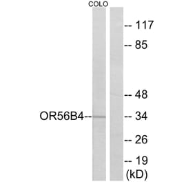 Western Blot - Anti-OR56B4 Antibody (G470) - Antibodies.com