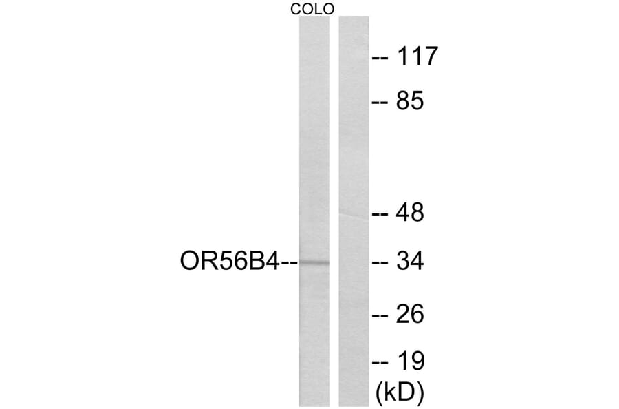 Western Blot - Anti-OR56B4 Antibody (G470) - Antibodies.com
