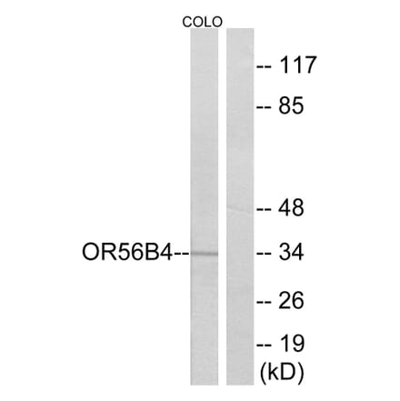 Western Blot - Anti-OR56B4 Antibody (G470) - Antibodies.com