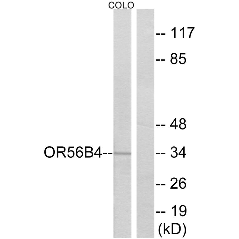 Western Blot - Anti-OR56B4 Antibody (G470) - Antibodies.com