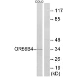 Western Blot - Anti-OR56B4 Antibody (G470) - Antibodies.com