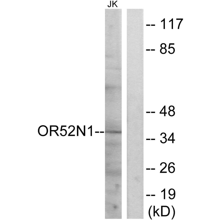 Western Blot - Anti-OR52N1 Antibody (G863) - Antibodies.com