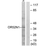 Western Blot - Anti-OR52N1 Antibody (G863) - Antibodies.com