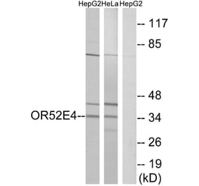 Western Blot - Anti-OR52E4 Antibody (G853) - Antibodies.com