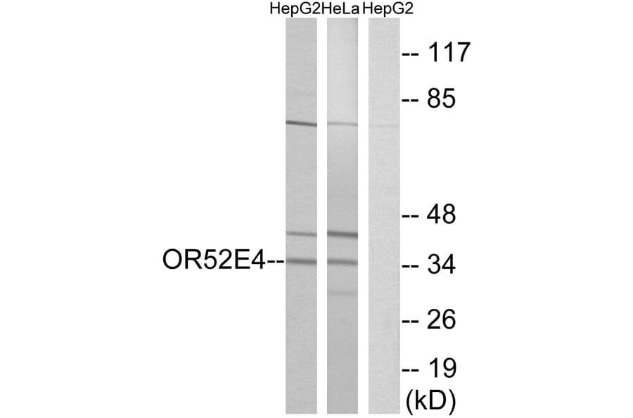 Western Blot - Anti-OR52E4 Antibody (G853) - Antibodies.com