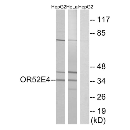 Western Blot - Anti-OR52E4 Antibody (G853) - Antibodies.com