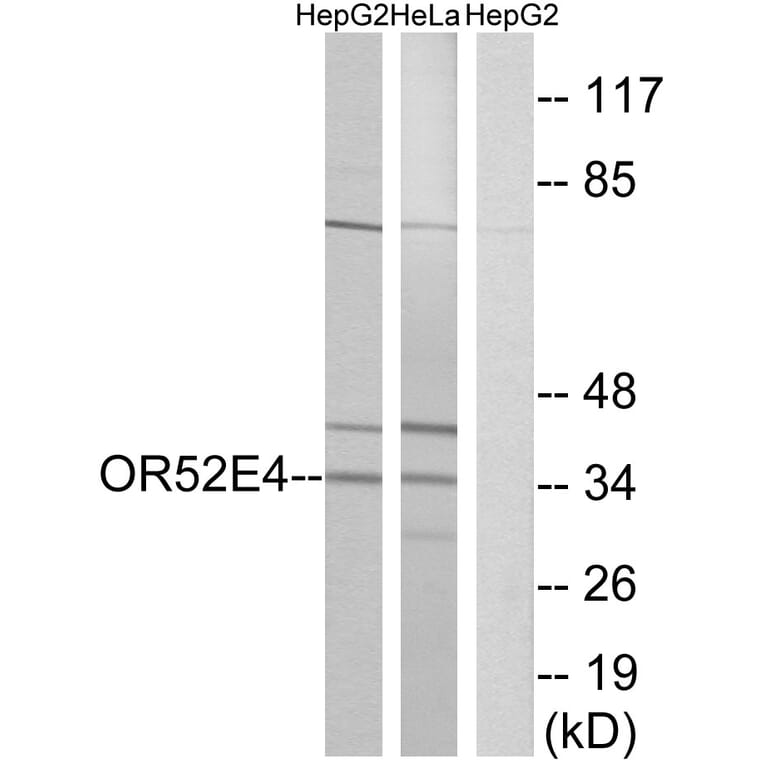 Western Blot - Anti-OR52E4 Antibody (G853) - Antibodies.com