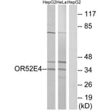Western Blot - Anti-OR52E4 Antibody (G853) - Antibodies.com