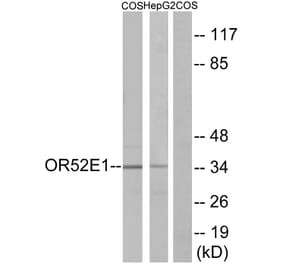 Western Blot - Anti-OR52E1 Antibody (G460) - Antibodies.com