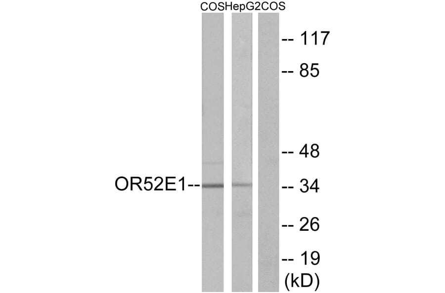 Western Blot - Anti-OR52E1 Antibody (G460) - Antibodies.com