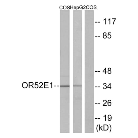 Western Blot - Anti-OR52E1 Antibody (G460) - Antibodies.com