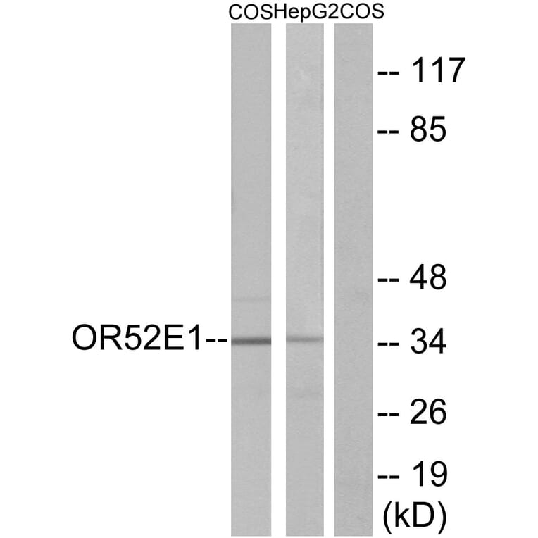 Western Blot - Anti-OR52E1 Antibody (G460) - Antibodies.com