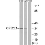 Western Blot - Anti-OR52E1 Antibody (G460) - Antibodies.com