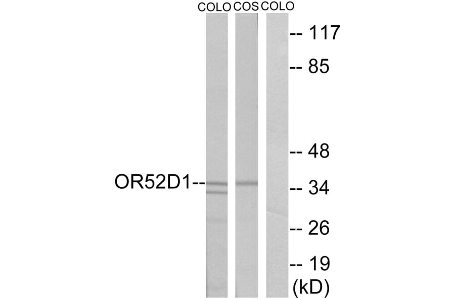 Western Blot - Anti-OR52D1 Antibody (G459) - Antibodies.com