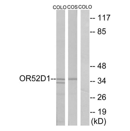 Western Blot - Anti-OR52D1 Antibody (G459) - Antibodies.com