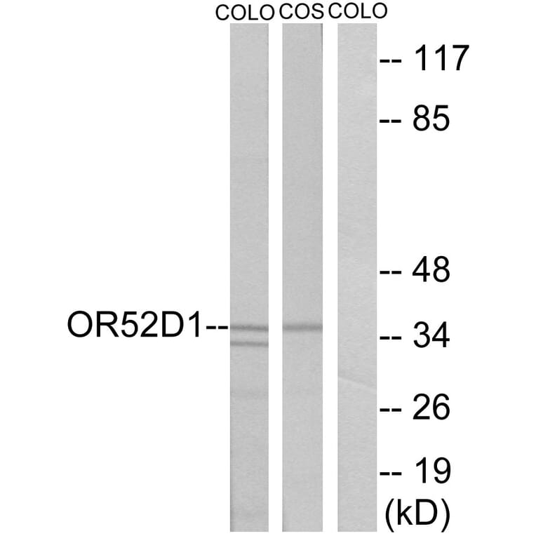 Western Blot - Anti-OR52D1 Antibody (G459) - Antibodies.com