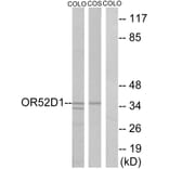 Western Blot - Anti-OR52D1 Antibody (G459) - Antibodies.com