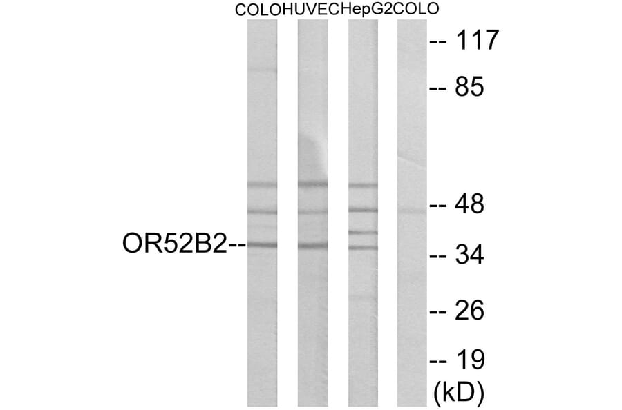 Western Blot - Anti-OR52B2 Antibody (G457) - Antibodies.com