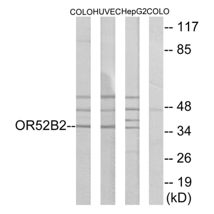 Western Blot - Anti-OR52B2 Antibody (G457) - Antibodies.com