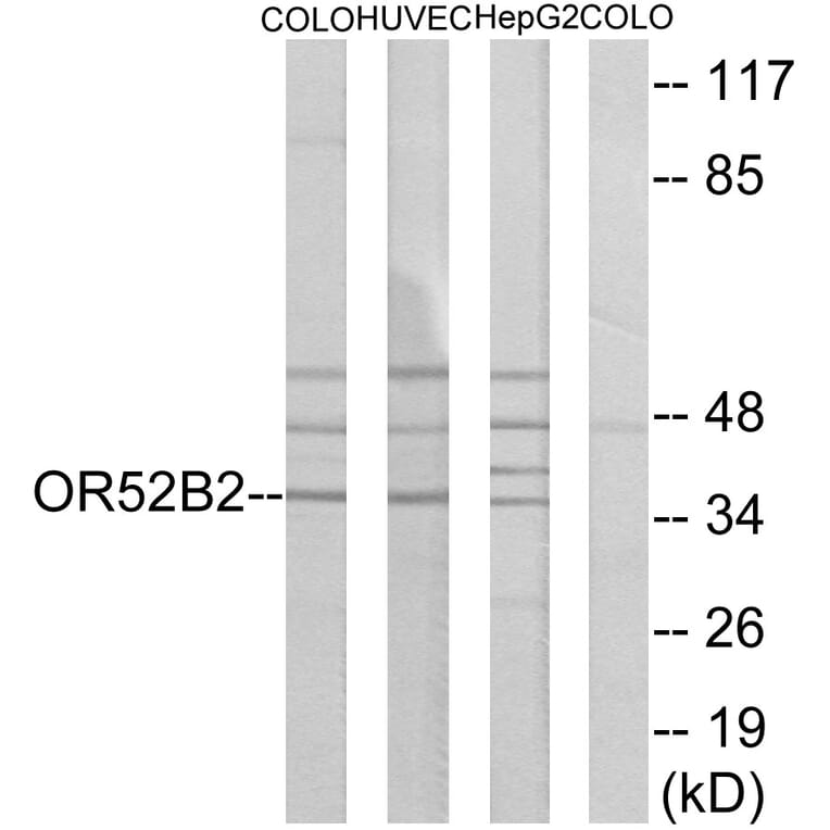 Western Blot - Anti-OR52B2 Antibody (G457) - Antibodies.com