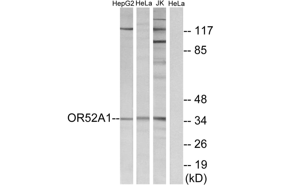 Western Blot - Anti-OR52A1 Antibody (G850) - Antibodies.com