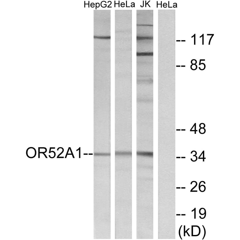 Western Blot - Anti-OR52A1 Antibody (G850) - Antibodies.com
