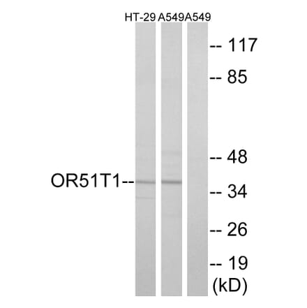 Western Blot - Anti-OR51T1 Antibody (G455) - Antibodies.com