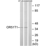 Western Blot - Anti-OR51T1 Antibody (G455) - Antibodies.com