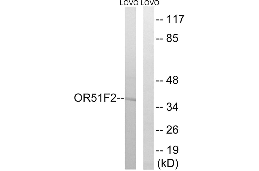 Western Blot - Anti-OR51F2 Antibody (G846) - Antibodies.com