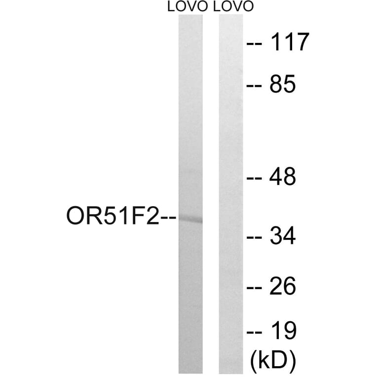 Western Blot - Anti-OR51F2 Antibody (G846) - Antibodies.com