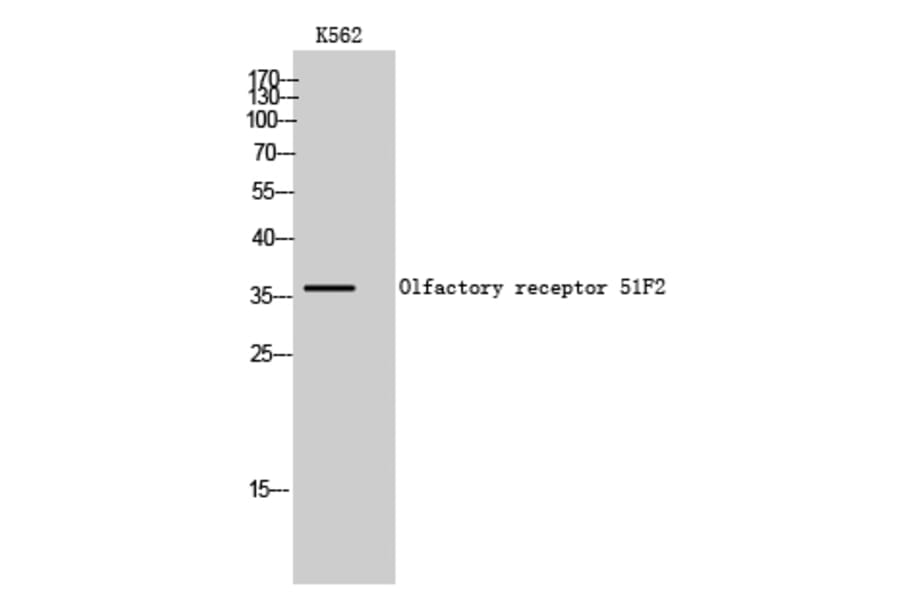 Western Blot - Anti-OR51F2 Antibody (G846) - Antibodies.com