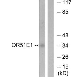 Western Blot - Anti-OR51E1 Antibody (G446) - Antibodies.com