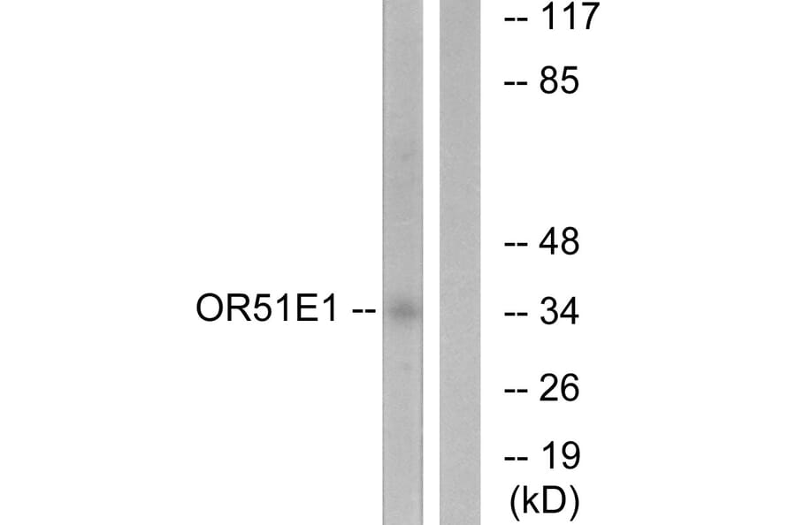 Western Blot - Anti-OR51E1 Antibody (G446) - Antibodies.com