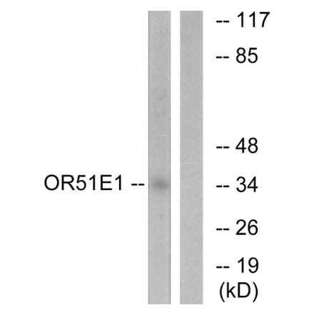 Western Blot - Anti-OR51E1 Antibody (G446) - Antibodies.com