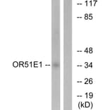 Western Blot - Anti-OR51E1 Antibody (G446) - Antibodies.com