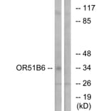 Western Blot - Anti-OR51B6 Antibody (G844) - Antibodies.com