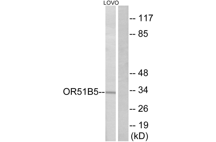 Western Blot - Anti-OR51B5 Antibody (G843) - Antibodies.com