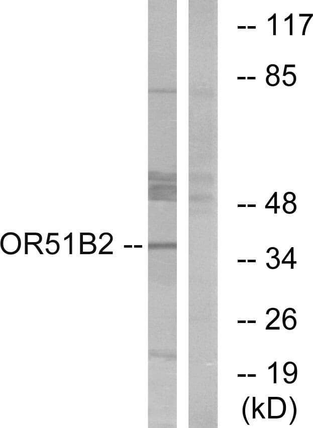 Western blot analysis of lysates from HT-29 cells using Anti-OR51B2 Antibody. The right hand lane represents a negative control, where the antibody is blocked by the immunising peptide.